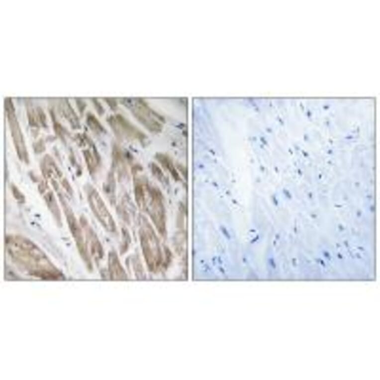 Immunohistochemistry - NDUFS5 Antibody from Signalway Antibody (34835) - Antibodies.com