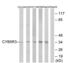 Western blot - CYB5R3 Antibody from Signalway Antibody (34837) - Antibodies.com
