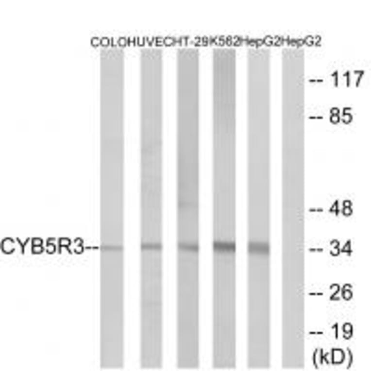 Western blot - CYB5R3 Antibody from Signalway Antibody (34837) - Antibodies.com