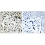 Immunohistochemistry - CYB5R3 Antibody from Signalway Antibody (34837) - Antibodies.com