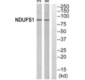 Western blot - NDUFS1 Antibody from Signalway Antibody (34838) - Antibodies.com