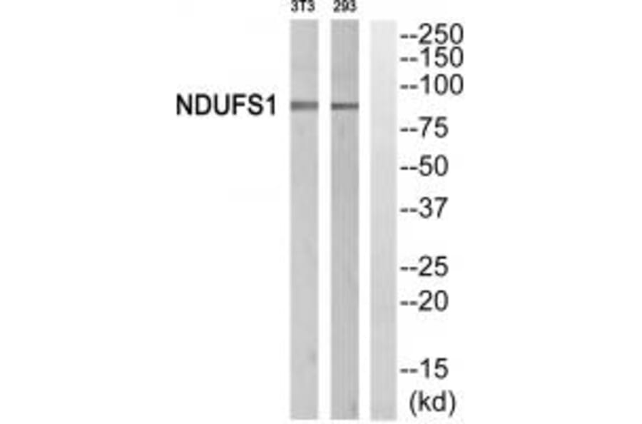 Western blot - NDUFS1 Antibody from Signalway Antibody (34838) - Antibodies.com