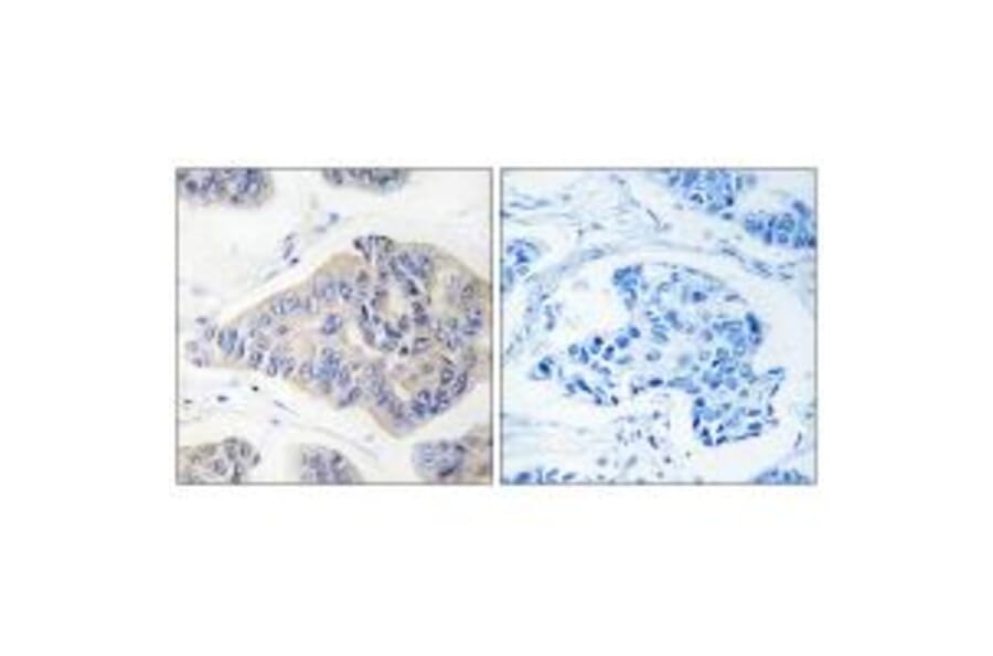 Immunohistochemistry - NDUFS1 Antibody from Signalway Antibody (34838) - Antibodies.com