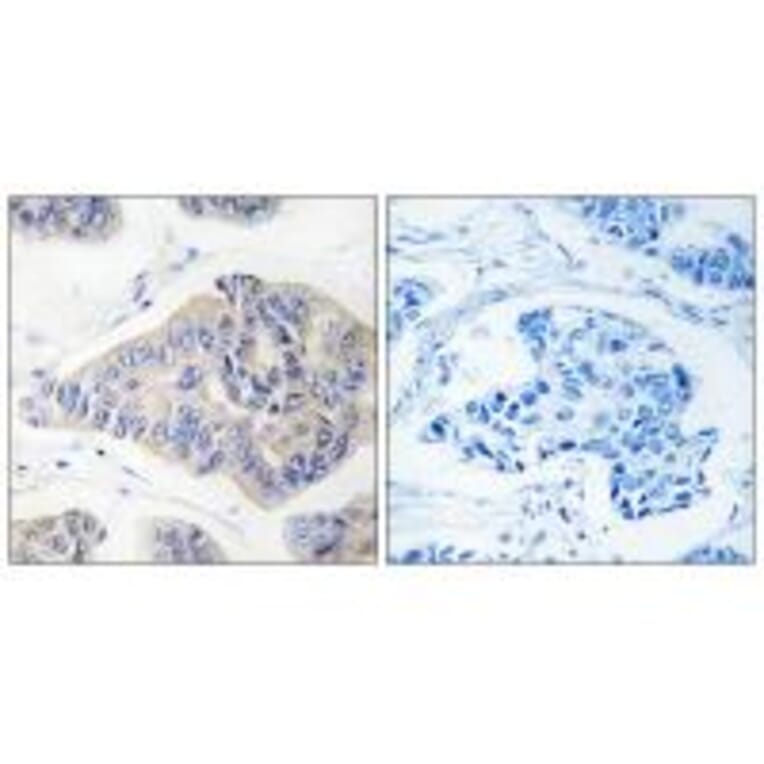 Immunohistochemistry - NDUFS1 Antibody from Signalway Antibody (34838) - Antibodies.com