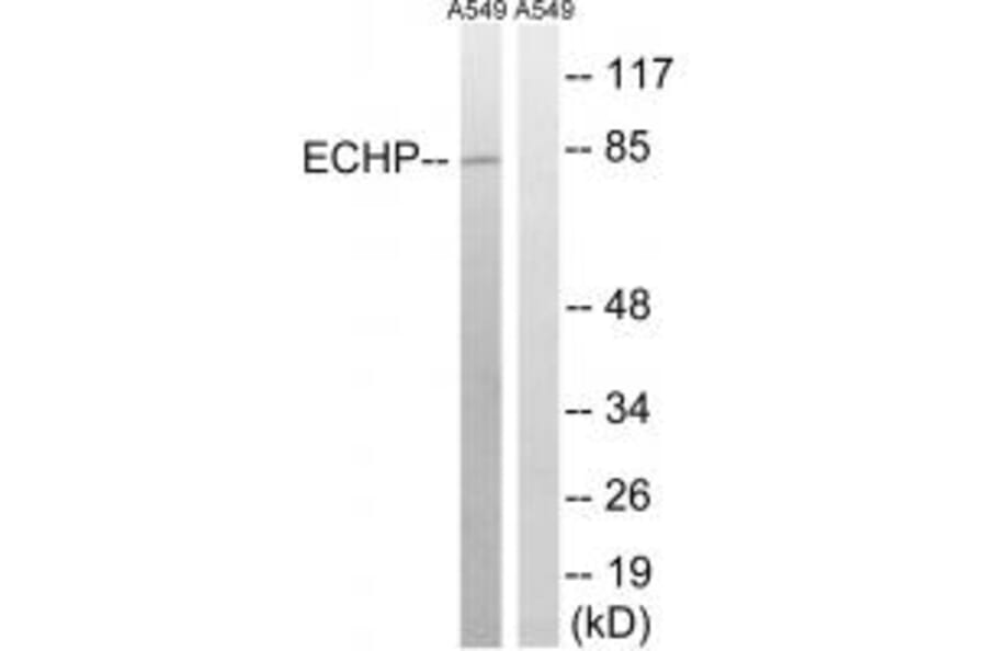 Western blot - EHHADH Antibody from Signalway Antibody (34890) - Antibodies.com