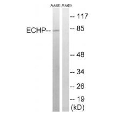 Western blot - EHHADH Antibody from Signalway Antibody (34890) - Antibodies.com