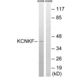 Western blot - KCNK15 Antibody from Signalway Antibody (34912) - Antibodies.com