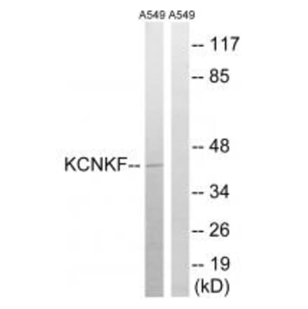 Western blot - KCNK15 Antibody from Signalway Antibody (34912) - Antibodies.com