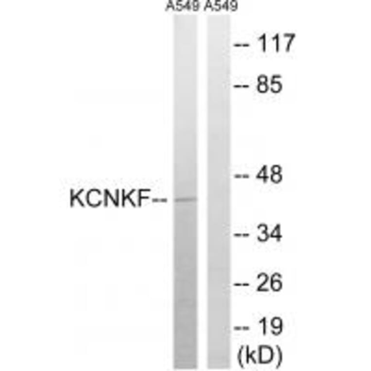 Western blot - KCNK15 Antibody from Signalway Antibody (34912) - Antibodies.com
