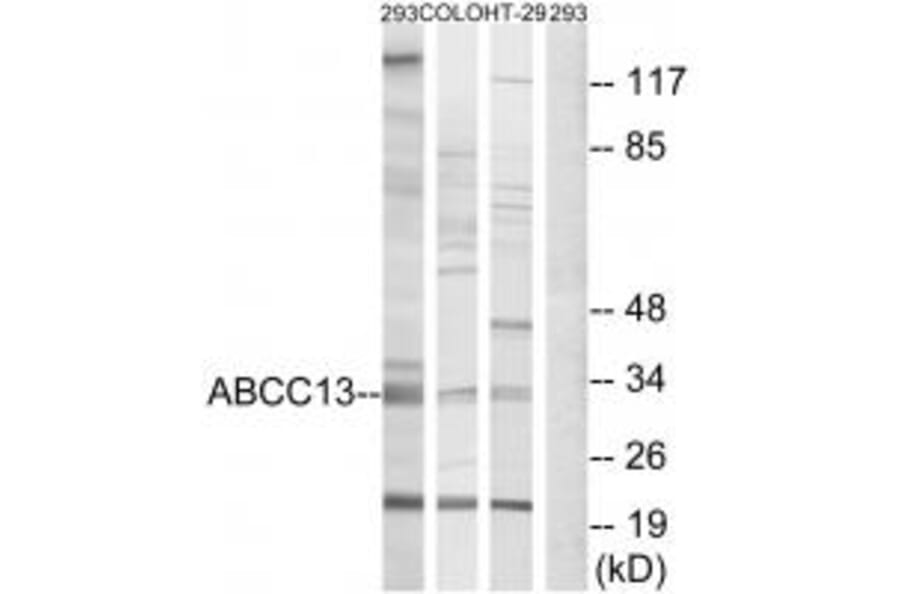 Western blot - ABCC13 Antibody from Signalway Antibody (34939) - Antibodies.com