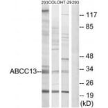Western blot - ABCC13 Antibody from Signalway Antibody (34939) - Antibodies.com