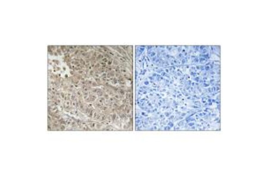 Immunohistochemistry - ABCC13 Antibody from Signalway Antibody (34939) - Antibodies.com