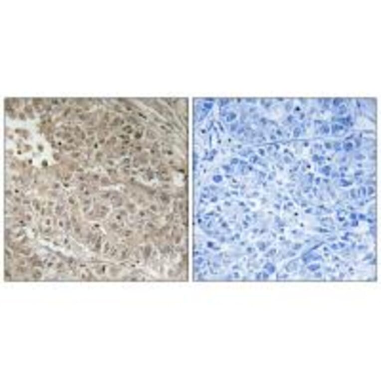 Immunohistochemistry - ABCC13 Antibody from Signalway Antibody (34939) - Antibodies.com