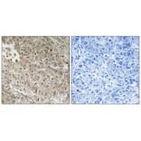 Immunohistochemistry - ABCC13 Antibody from Signalway Antibody (34939) - Antibodies.com