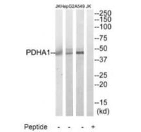 Western blot - PDHA1 Antibody from Signalway Antibody (34946) - Antibodies.com