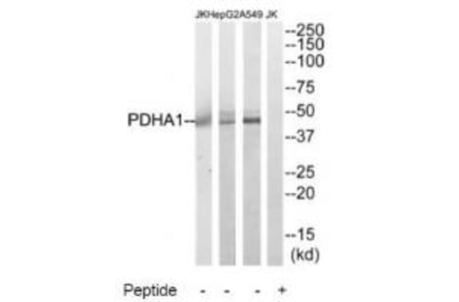 Western blot - PDHA1 Antibody from Signalway Antibody (34946) - Antibodies.com