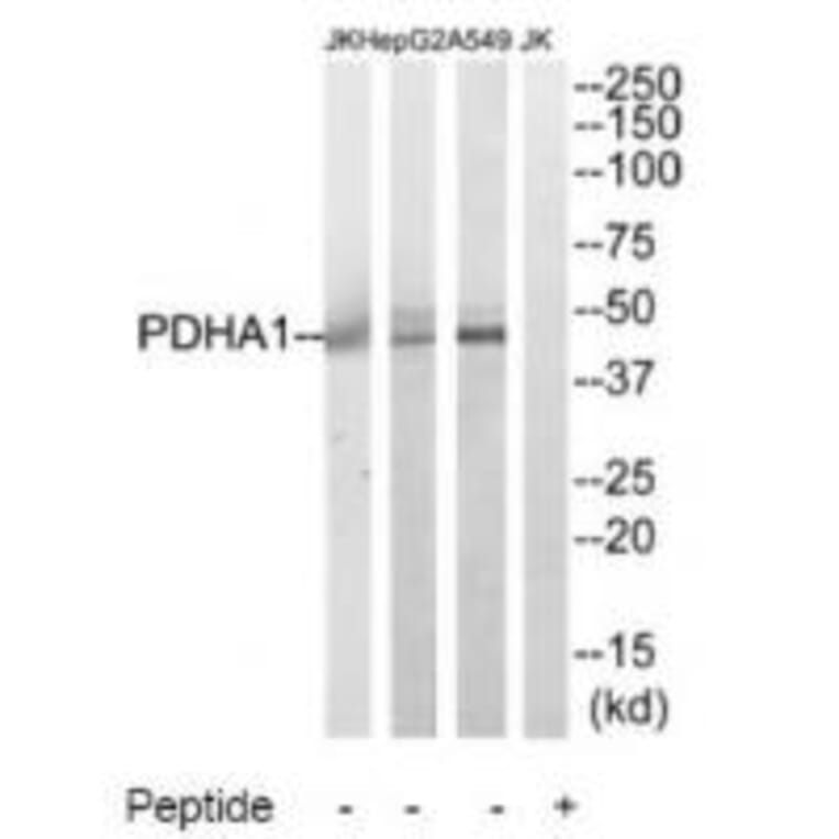 Western blot - PDHA1 Antibody from Signalway Antibody (34946) - Antibodies.com