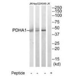 Western blot - PDHA1 Antibody from Signalway Antibody (34946) - Antibodies.com