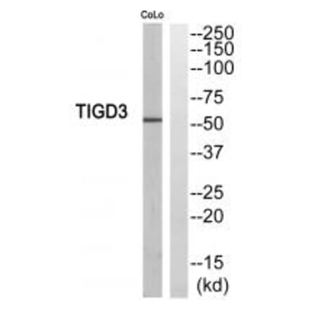 Western blot - TIGD3 Antibody from Signalway Antibody (35096) - Antibodies.com