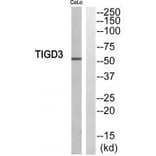 Western blot - TIGD3 Antibody from Signalway Antibody (35096) - Antibodies.com
