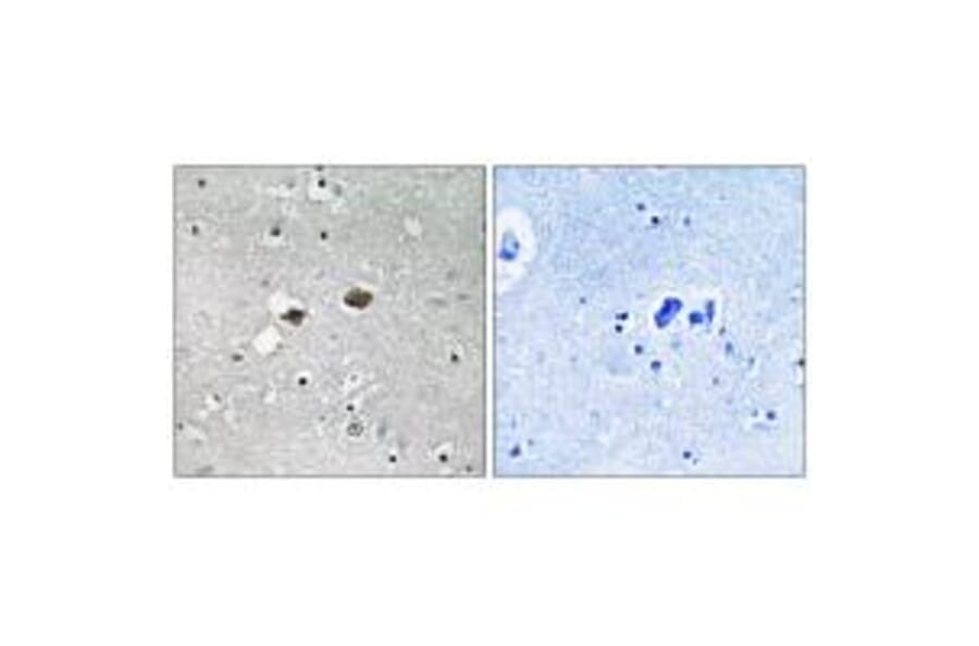 Immunohistochemistry - TIGD3 Antibody from Signalway Antibody (35096) - Antibodies.com