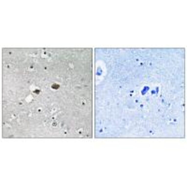 Immunohistochemistry - TIGD3 Antibody from Signalway Antibody (35096) - Antibodies.com