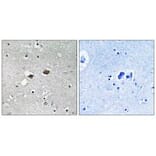 Immunohistochemistry - TIGD3 Antibody from Signalway Antibody (35096) - Antibodies.com