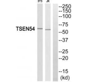 Western blot - TSEN54 Antibody from Signalway Antibody (35110) - Antibodies.com