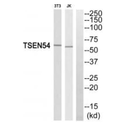 Western blot - TSEN54 Antibody from Signalway Antibody (35110) - Antibodies.com