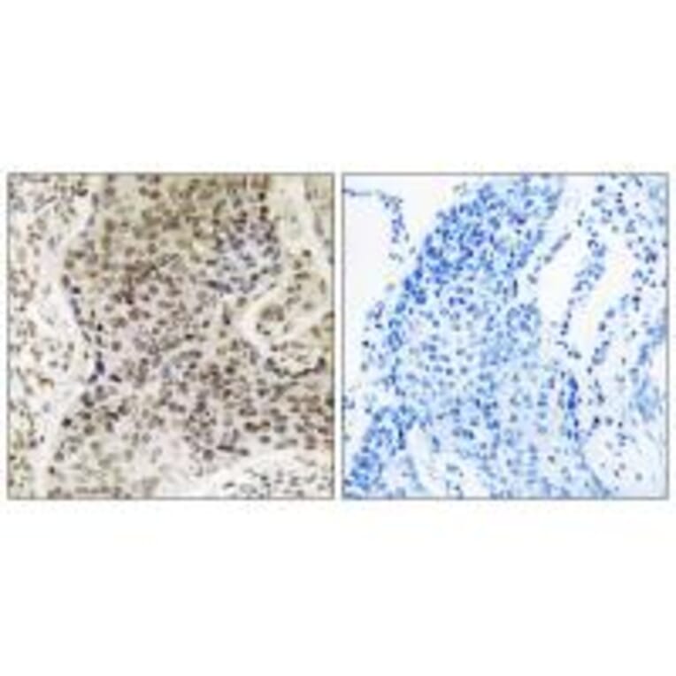 Immunohistochemistry - TSEN54 Antibody from Signalway Antibody (35110) - Antibodies.com