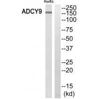 Western blot analysis of extracts from HuvEc cells, using ADCY9 antibody #35174.