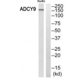Western blot - ADCY9 Antibody from Signalway Antibody (35174) - Antibodies.com