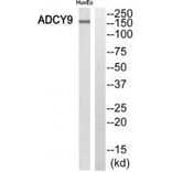 Western blot - ADCY9 Antibody from Signalway Antibody (35174) - Antibodies.com