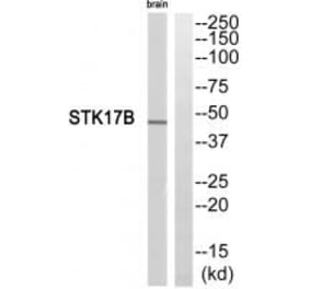 Western blot - STK17B Antibody from Signalway Antibody (35283) - Antibodies.com