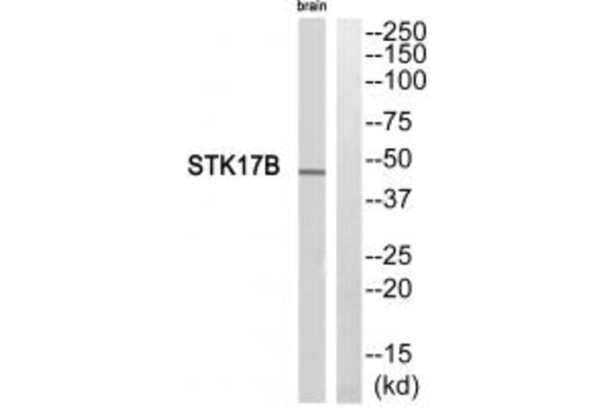 Western blot - STK17B Antibody from Signalway Antibody (35283) - Antibodies.com