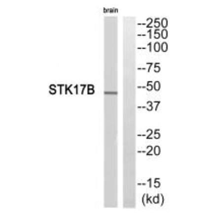 Western blot - STK17B Antibody from Signalway Antibody (35283) - Antibodies.com