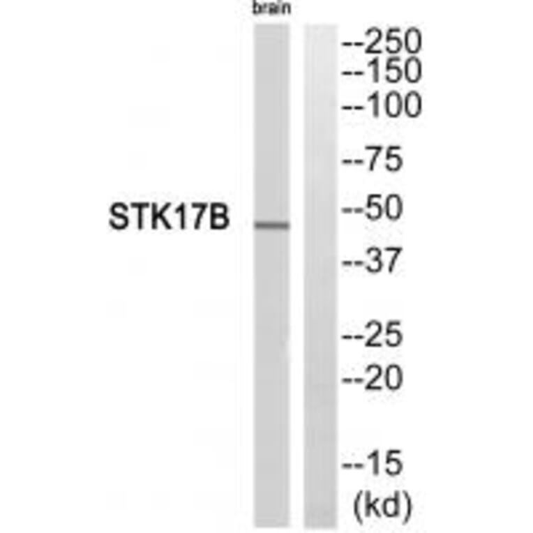 Western blot - STK17B Antibody from Signalway Antibody (35283) - Antibodies.com