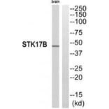 Western blot - STK17B Antibody from Signalway Antibody (35283) - Antibodies.com