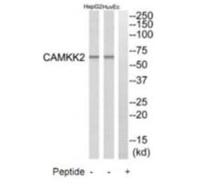 Western blot - CAMKK2 Antibody from Signalway Antibody (35298) - Antibodies.com