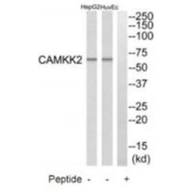 Western blot - CAMKK2 Antibody from Signalway Antibody (35298) - Antibodies.com