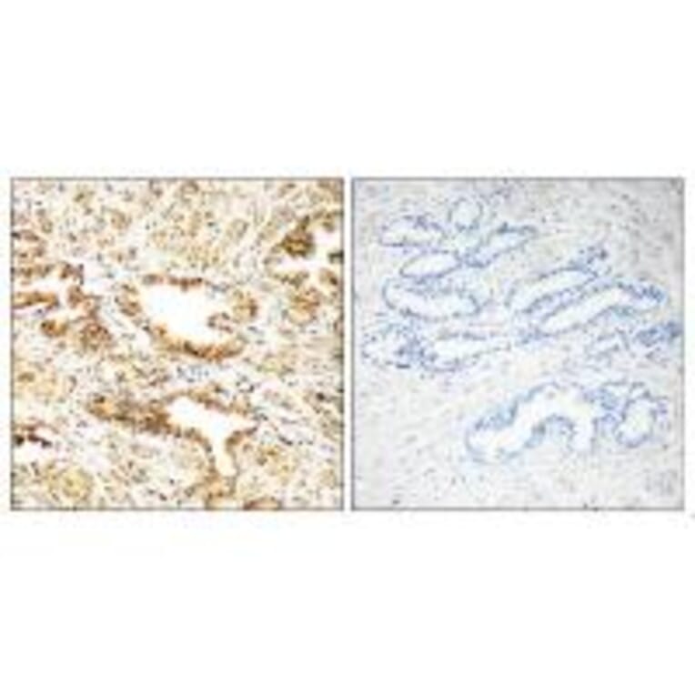 Immunohistochemistry - CAMKK2 Antibody from Signalway Antibody (35298) - Antibodies.com