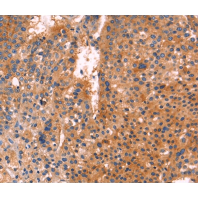 Immunohistochemistry - ANTXR1 Antibody from Signalway Antibody (35567) - Antibodies.com