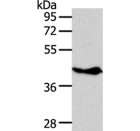NFKBIE Antibody from Signalway Antibody (35589) - Antibodies.com
