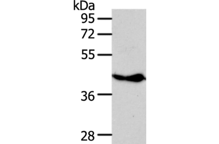 NFKBIE Antibody from Signalway Antibody (35589) - Antibodies.com