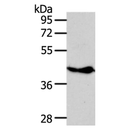 NFKBIE Antibody from Signalway Antibody (35589) - Antibodies.com