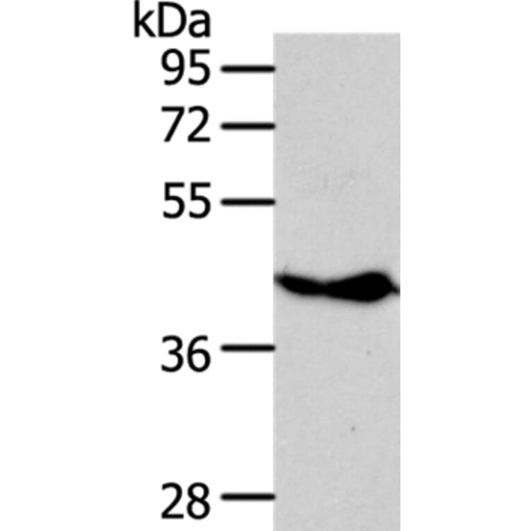 NFKBIE Antibody from Signalway Antibody (35589) - Antibodies.com