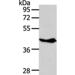 NFKBIE Antibody from Signalway Antibody (35589) - Antibodies.com