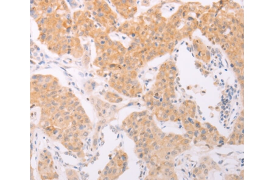 Immunohistochemistry - NFKBIE Antibody from Signalway Antibody (35589) - Antibodies.com