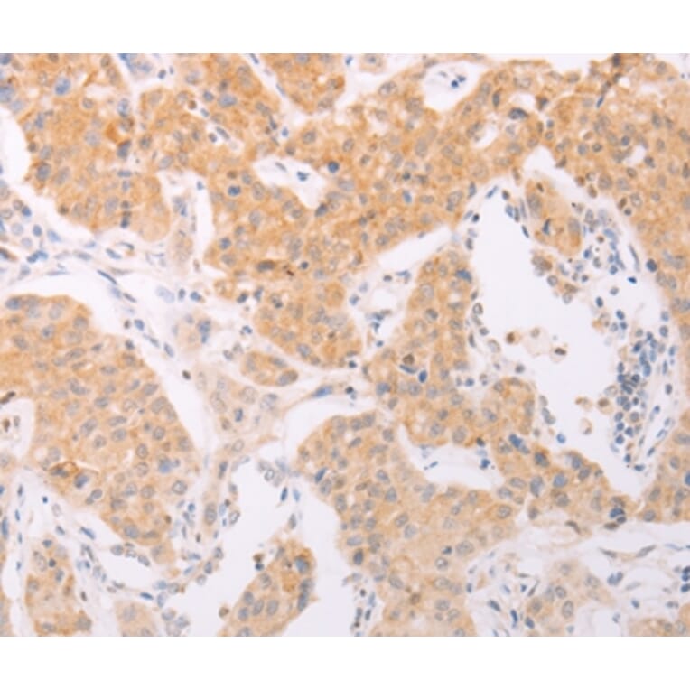 Immunohistochemistry - NFKBIE Antibody from Signalway Antibody (35589) - Antibodies.com