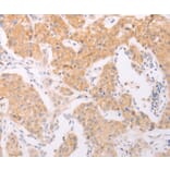 Immunohistochemistry - NFKBIE Antibody from Signalway Antibody (35589) - Antibodies.com